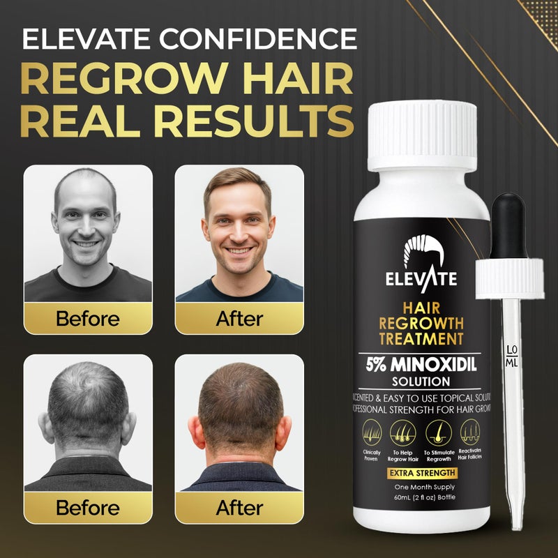 Elevate Hair Regrowth Treatment 5% Minoxidil Solution for Hair Growth - Extra Strength Topical Hair Growth Serum for Thicker, Fuller Hair 2 Fl Oz Made in USA - Image 3